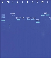 Jundishapur J Microbiol